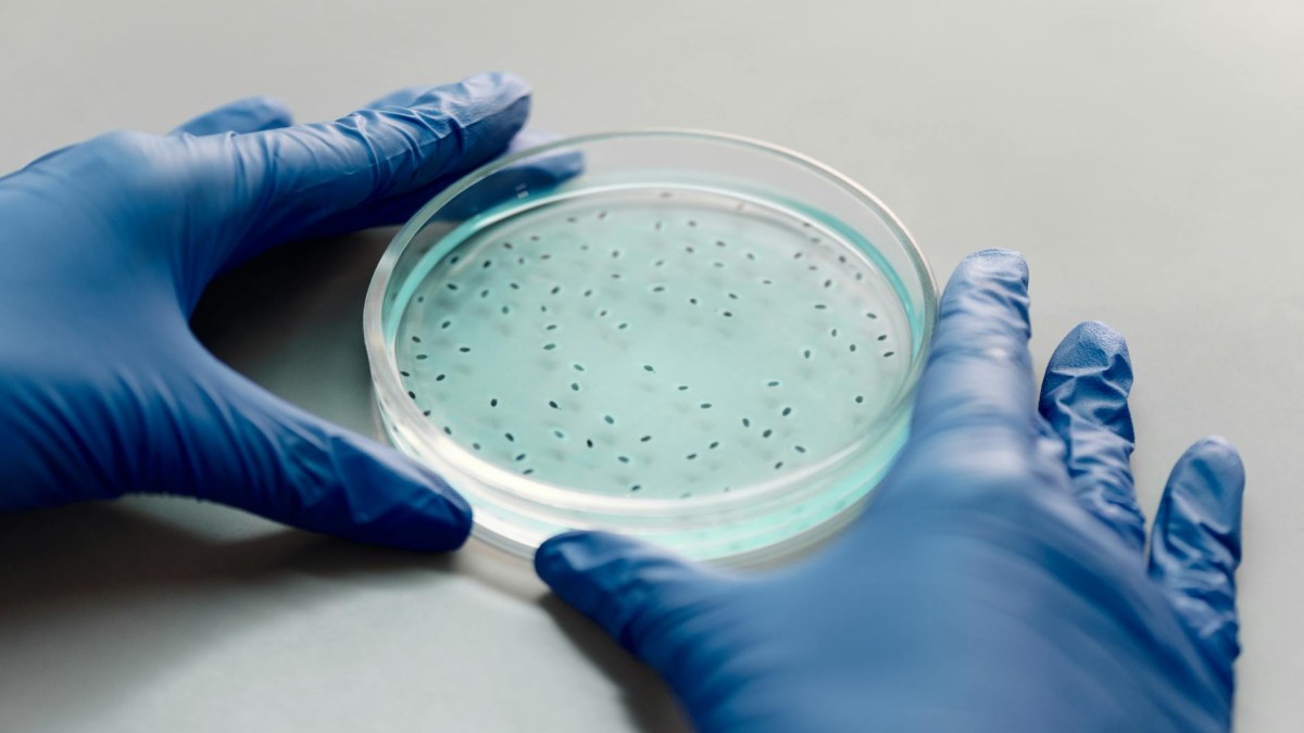 Antibiyotik Direnci: Nedenleri ve Korunma Yöntemleri