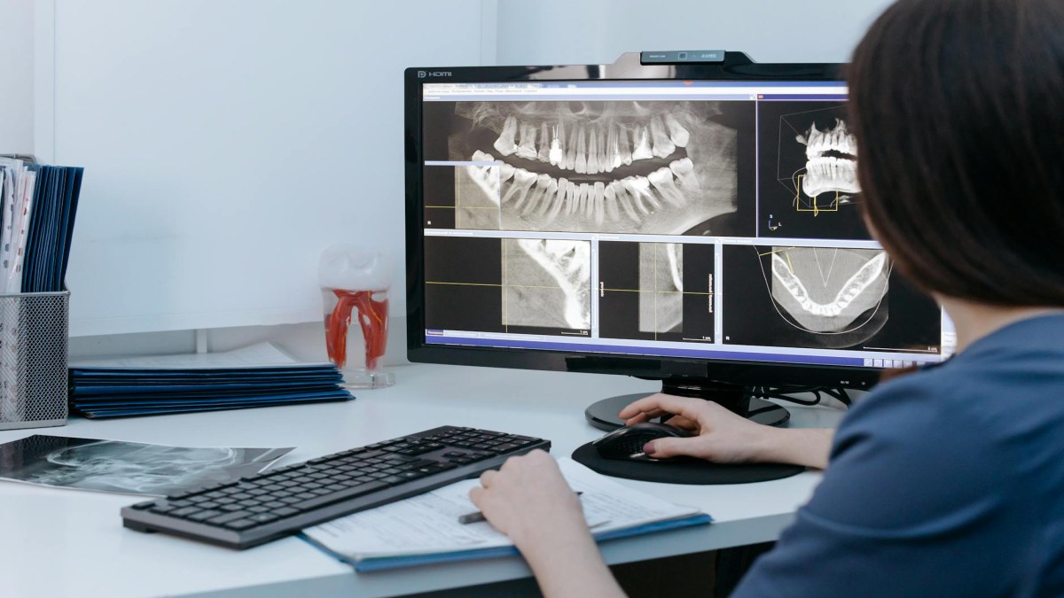 Ağız Radyolojisi ile Diş Sağlığınızı Korumanın Yolları
