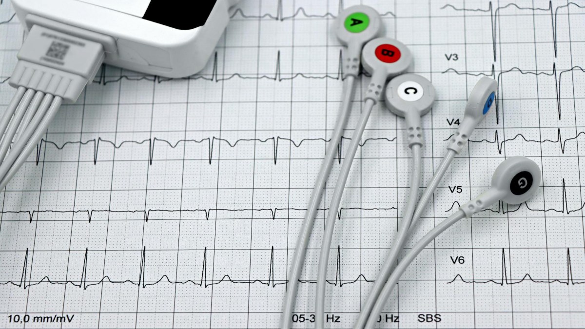 Kalp çarpıntısı neden olur, ne zaman ciddidir?