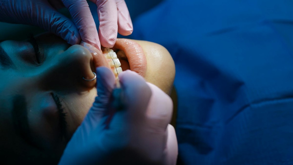 Çocuklarda Ortodontik Tedavi: Ne Zaman Başlamalı?