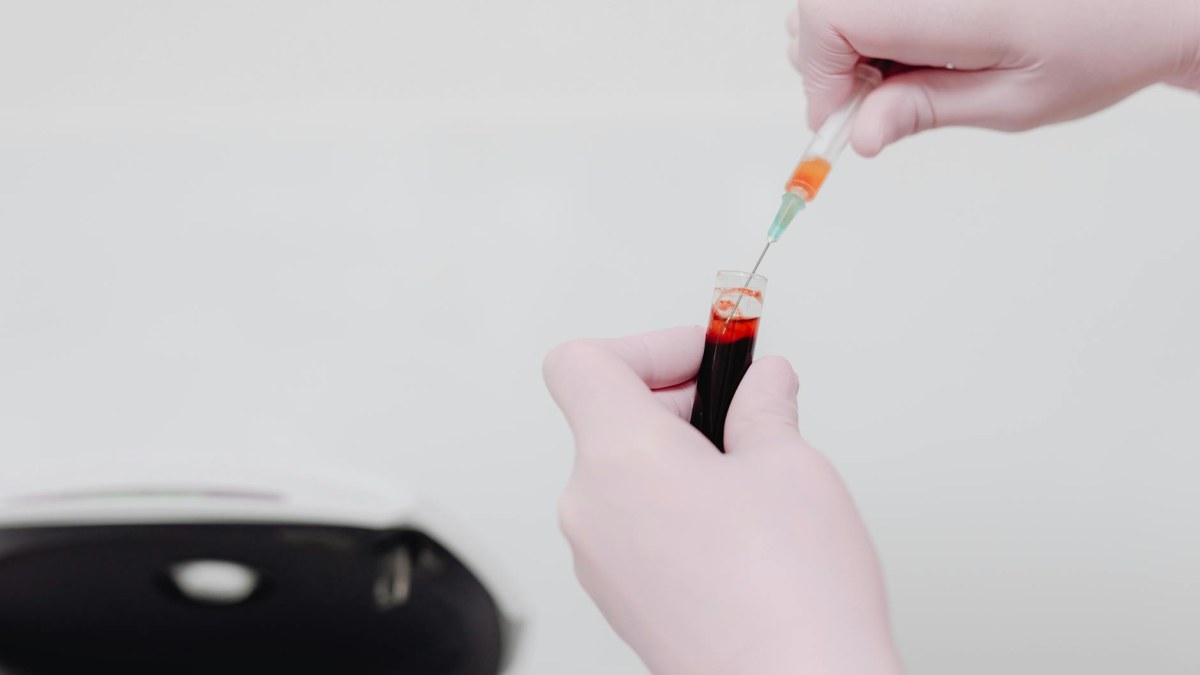 Patolojik Doku İncelemeleri ve Kanser Erken Teşhisi