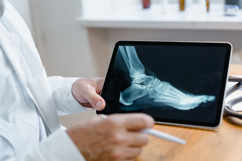Platin Çıkarma Ameliyatı Öncesi Ağrı Değerlendirmesi