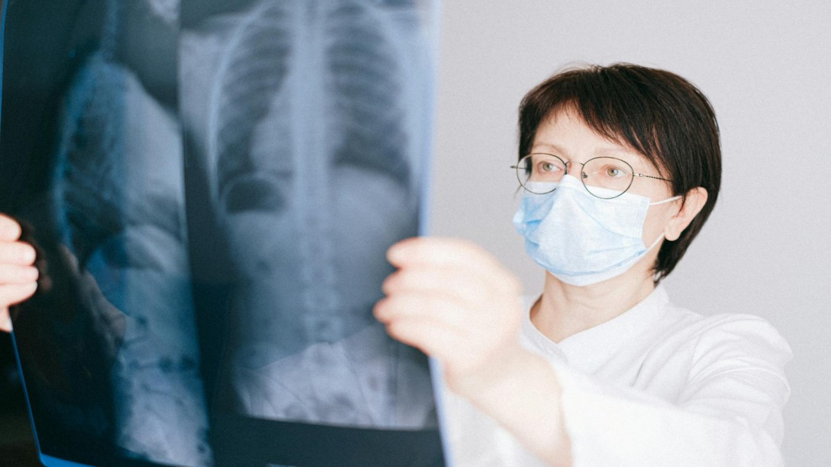 Tüberküloz Aşısı Hakkında Bilinmesi Gerekenler