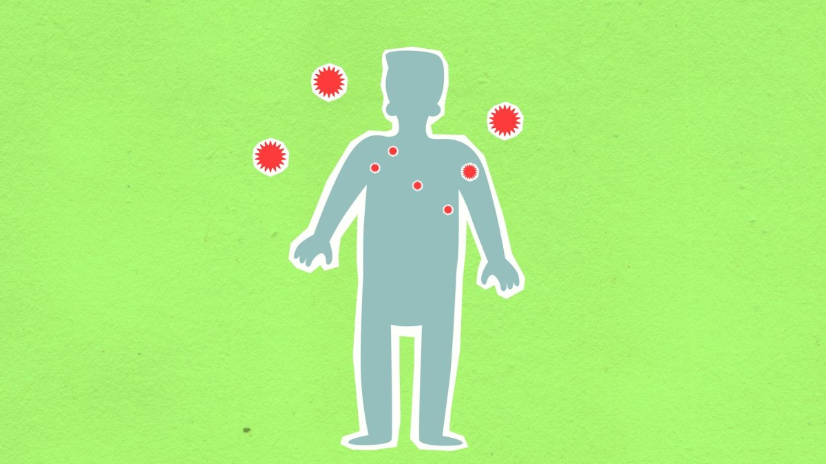 Türkiye'de En Sık Görülen Enfeksiyon Hastalıkları ve Belirtileri