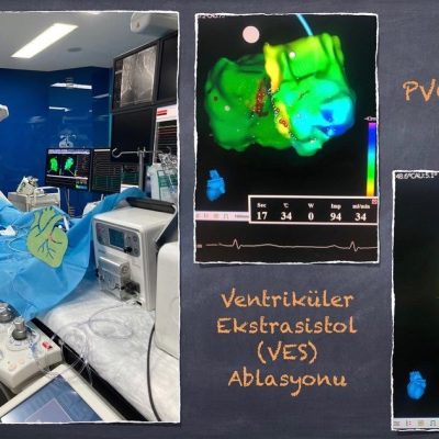 Prof. Dr. Mustafa Adem Tatlısu - Kardiyoloji - İstanbul