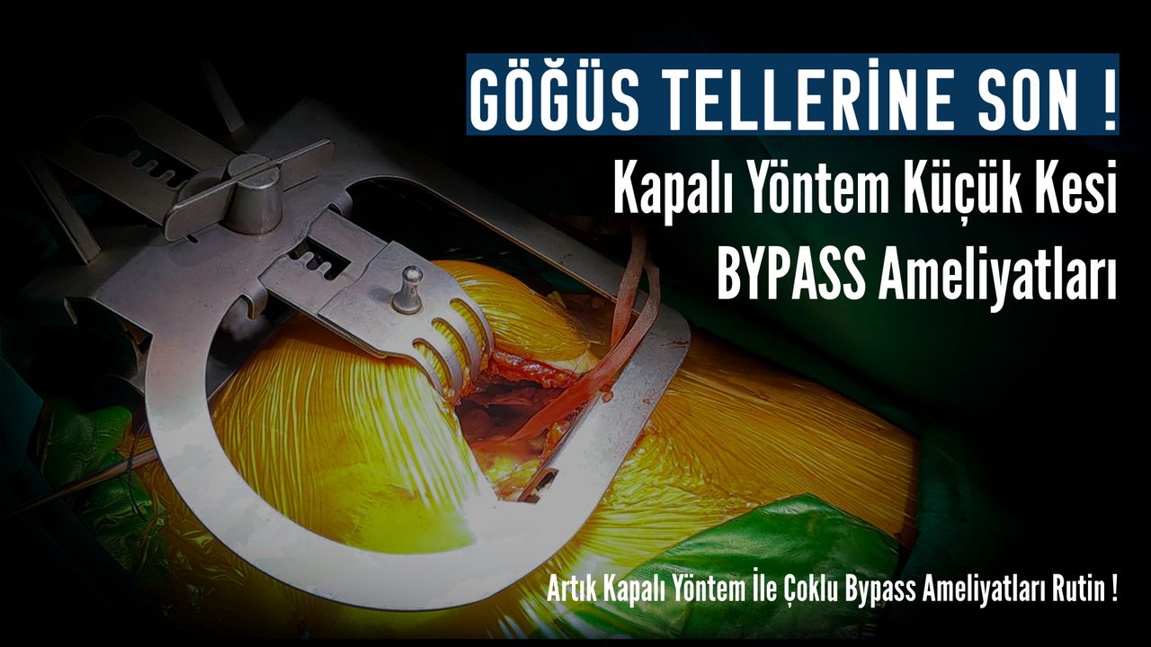 Tayfun Aybek