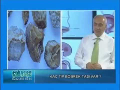 Doç. Dr Mustafa Burak Hoşcan - Böbrek taşları nedir, nasıl oluşur, korunma ve tedavi yöntemleri