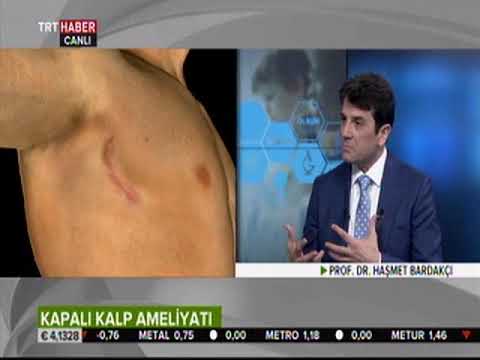 Kapalı kalp ameliyatı - Prof. Dr. Haşmet Bardakçı - TRT Haber (06.07.2017)